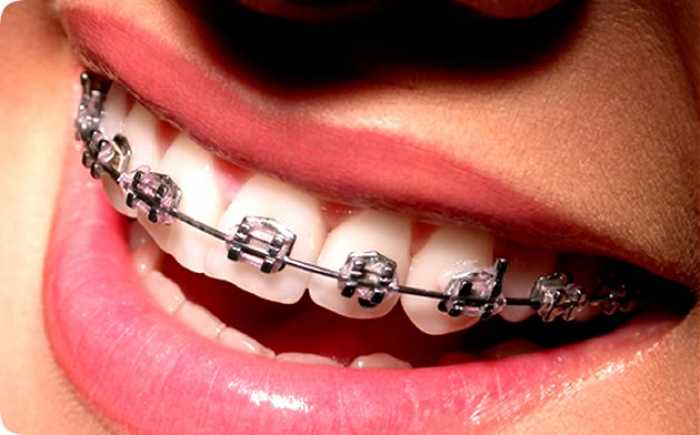 Sorridents Vila Perus